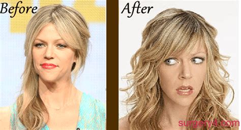 kaitlin olsen plastic surgery|Kaitlin Olsons Plastic Surgery: What Other。